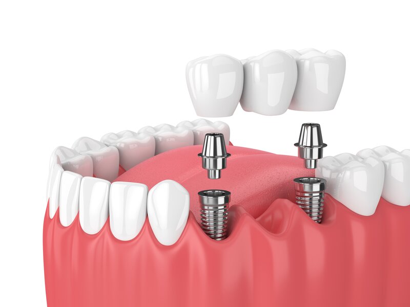 Implantis Dental Care - Clinica stomatologica