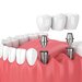 Implantis Dental Care - Clinica stomatologica